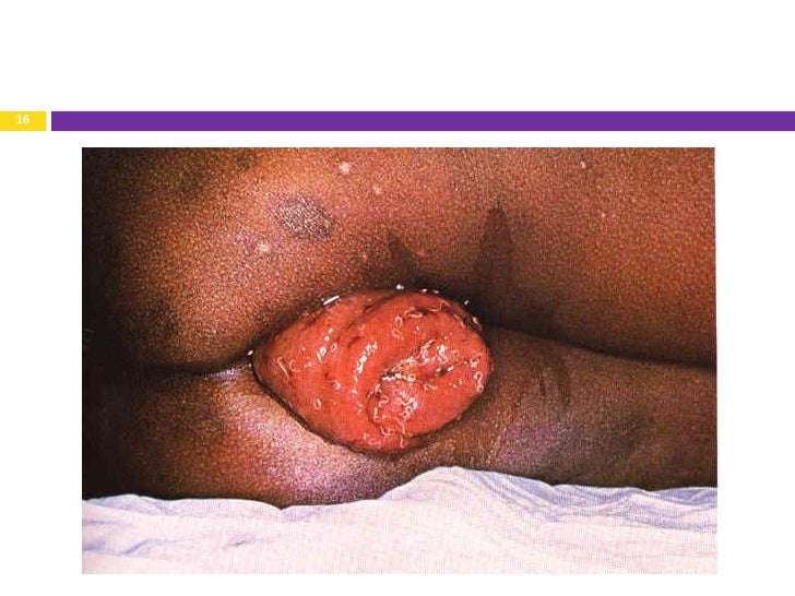 little amateur naked virgin teens pics mucous from rectum after masturbation